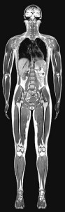MRI-full-body12-10-09-93x300